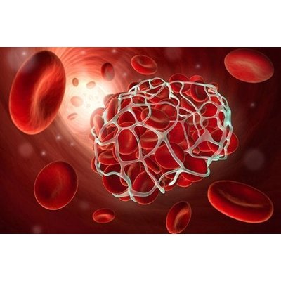 A new drug is able to prevent thrombosis effectively