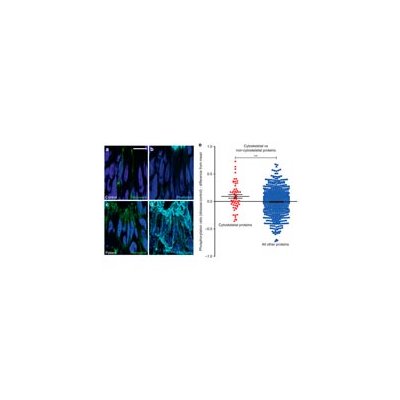 Scientists have revealed a gene causing a loss of vision