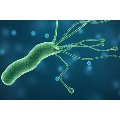 Helicobacter pylori is strongly associated with CVD